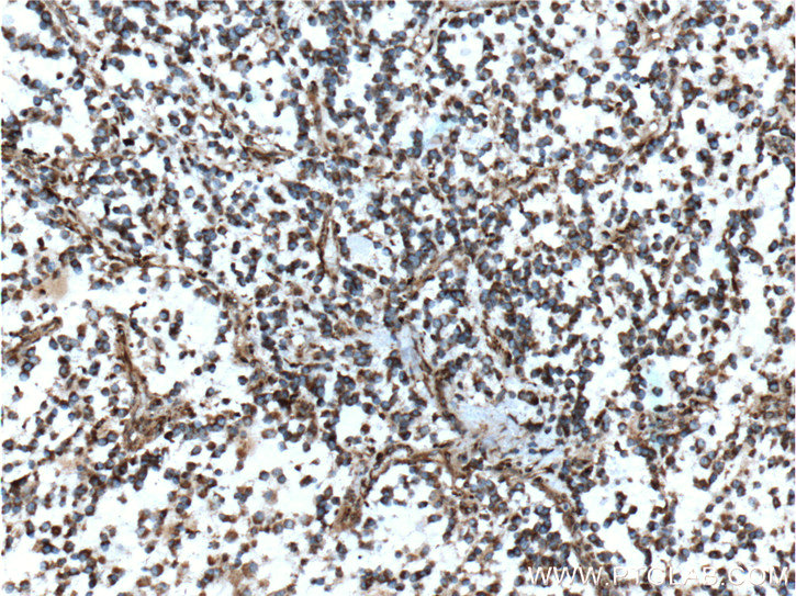 MGP Monoclonal antibody