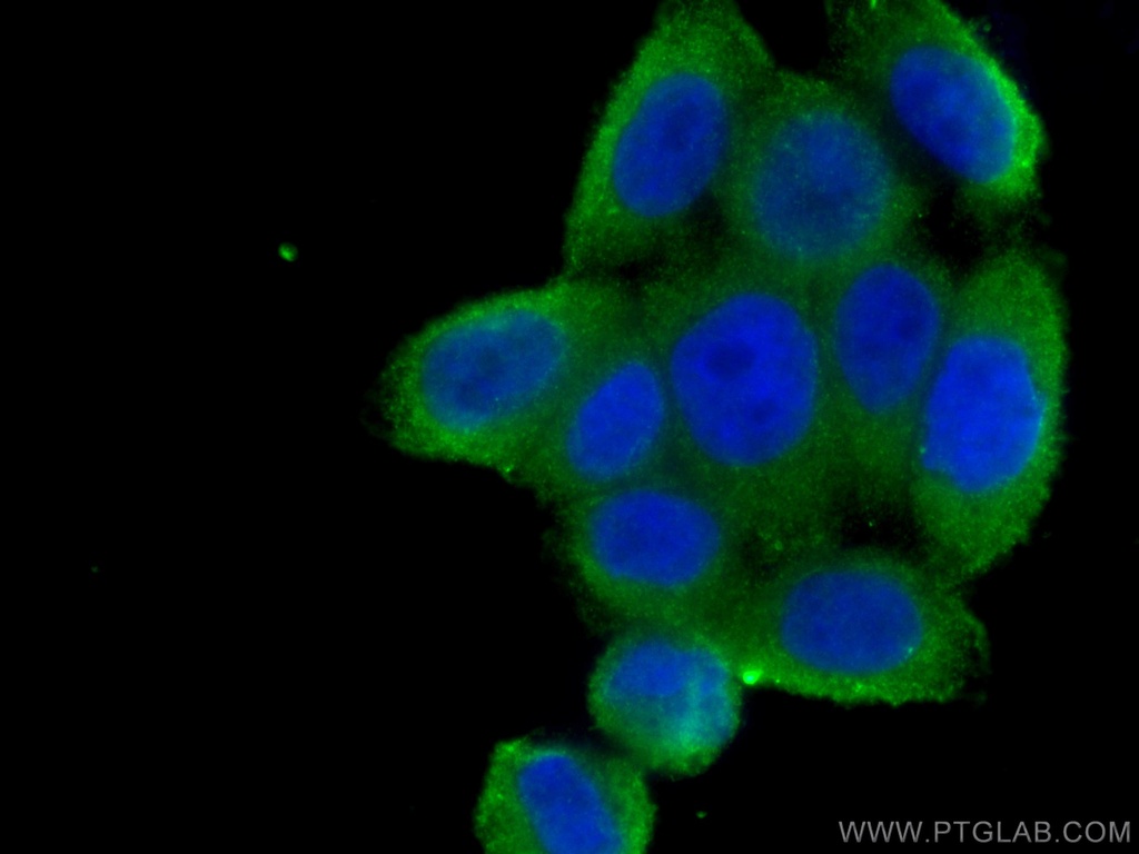 PLOD3 Monoclonal antibody