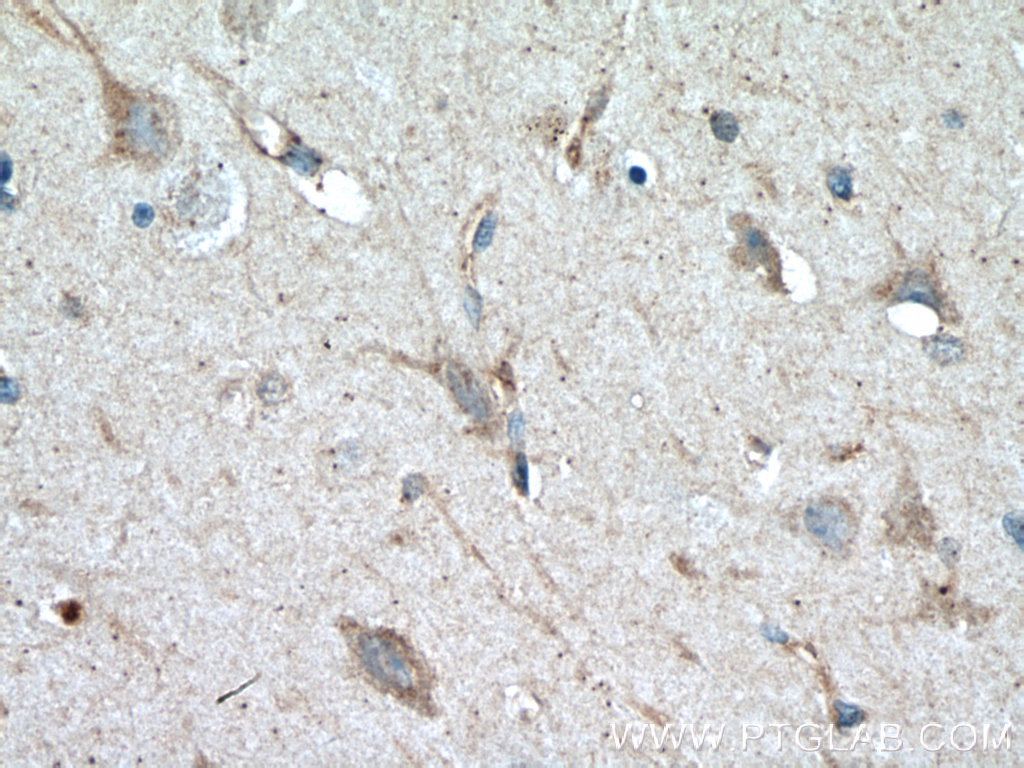 Syntaxin 6 Monoclonal antibody