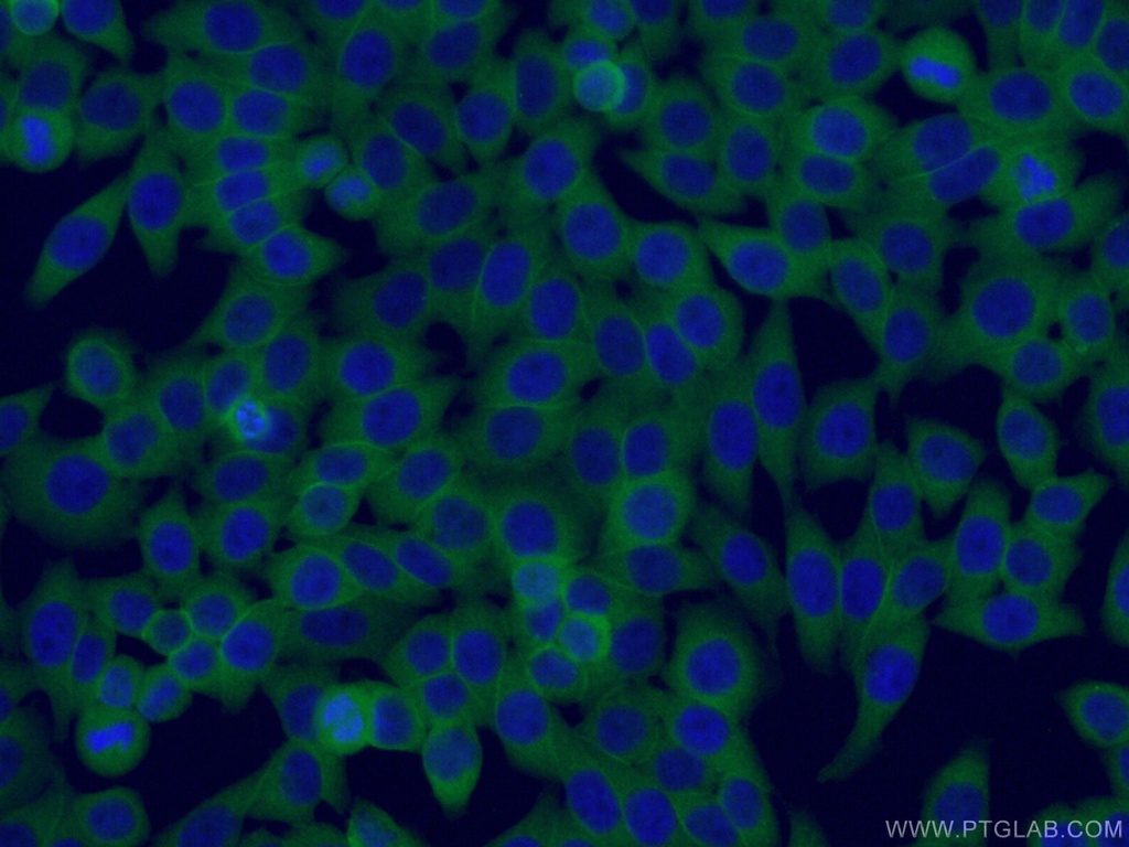 Follistatin Monoclonal antibody