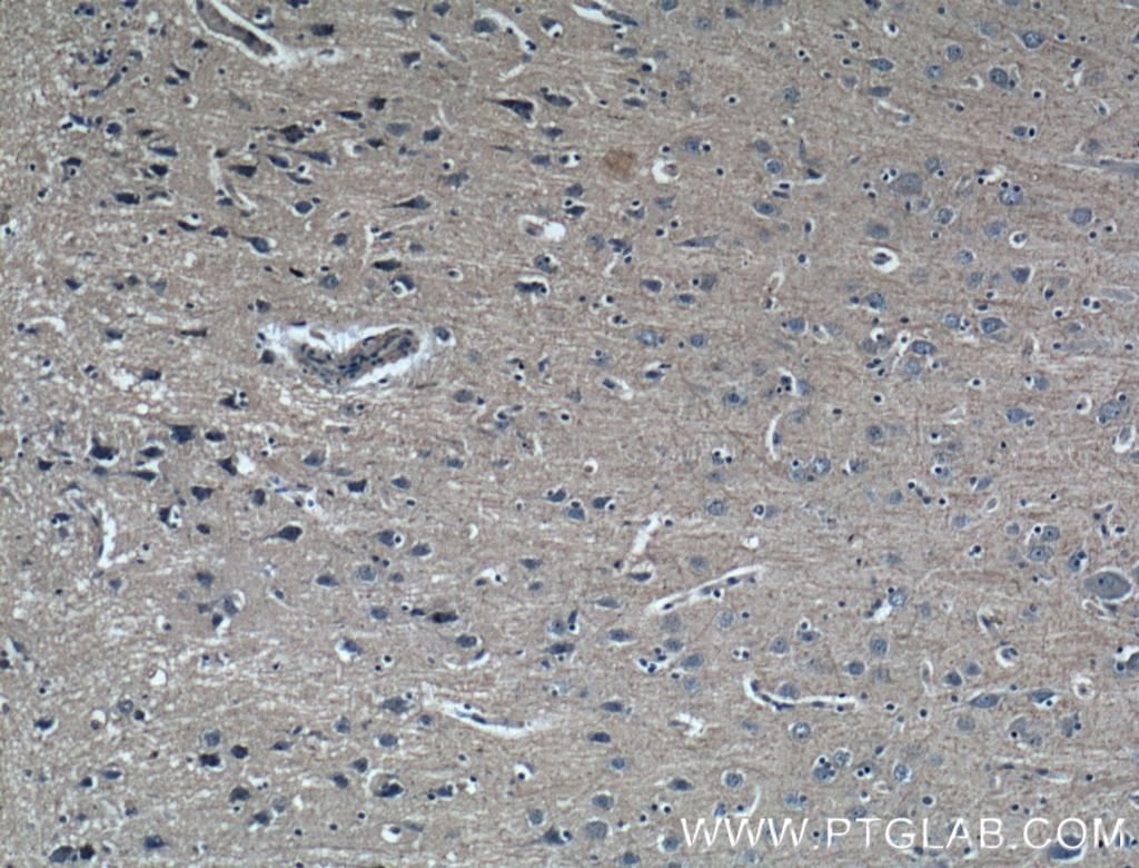 GMF Beta Monoclonal antibody