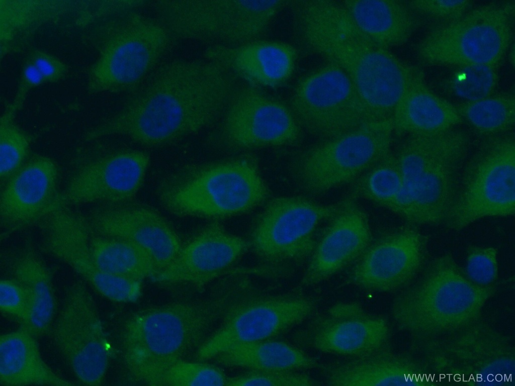 LGALS3BP Monoclonal antibody