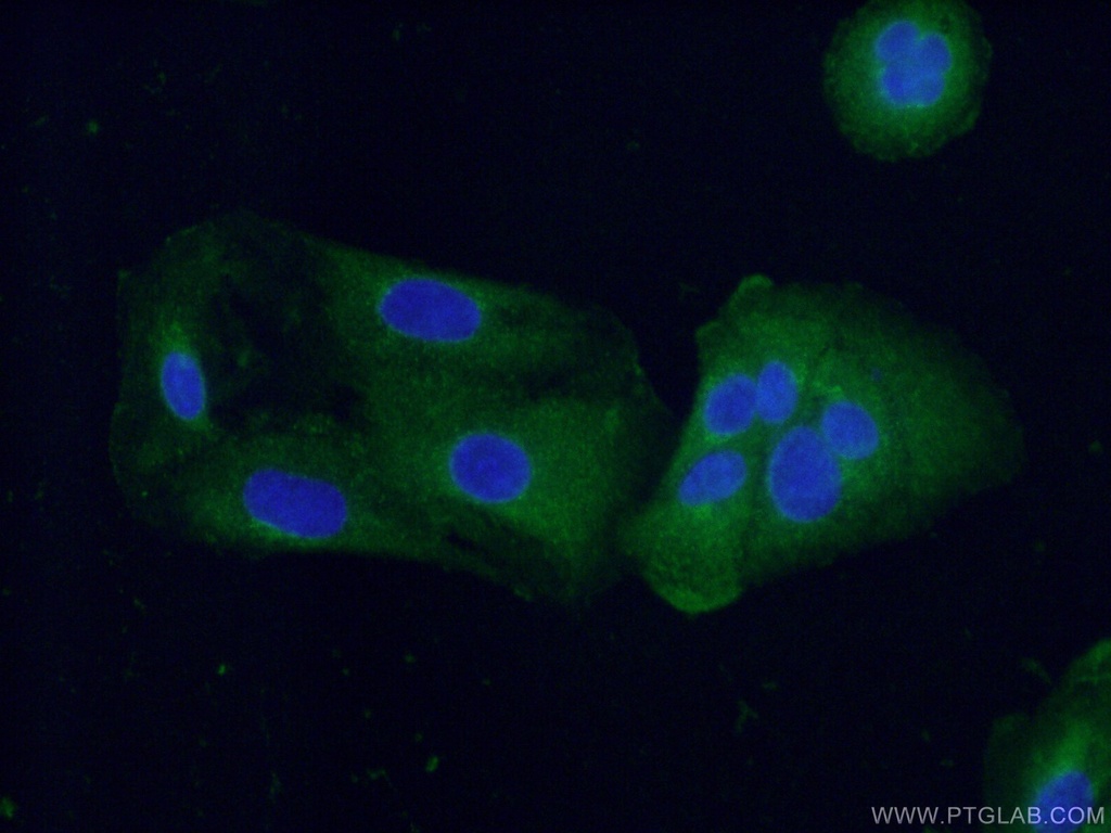 Fibulin 5 Monoclonal antibody