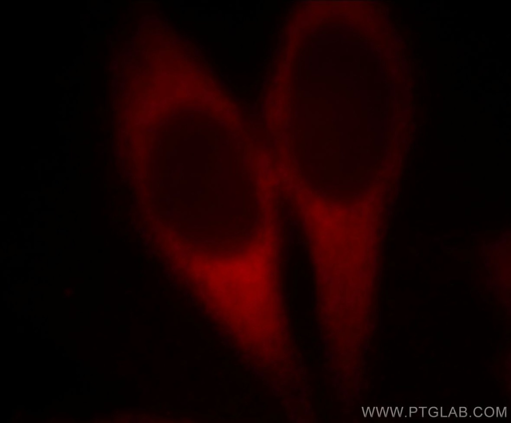 EEF1D Monoclonal antibody