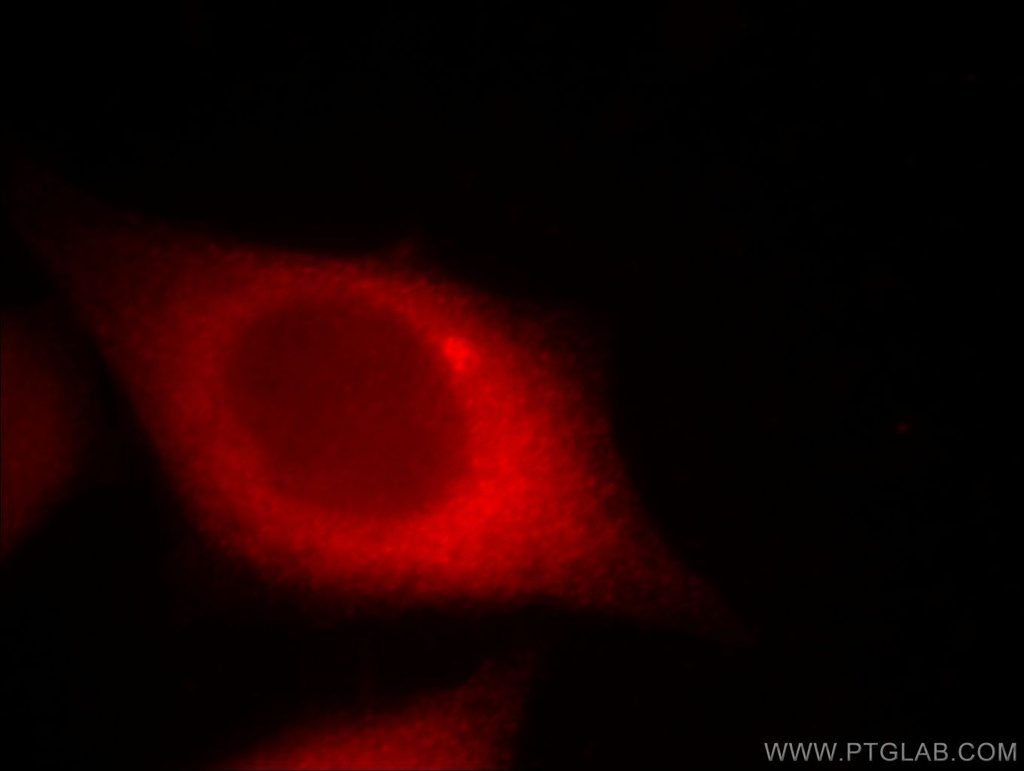 CTAGE1 Monoclonal antibody
