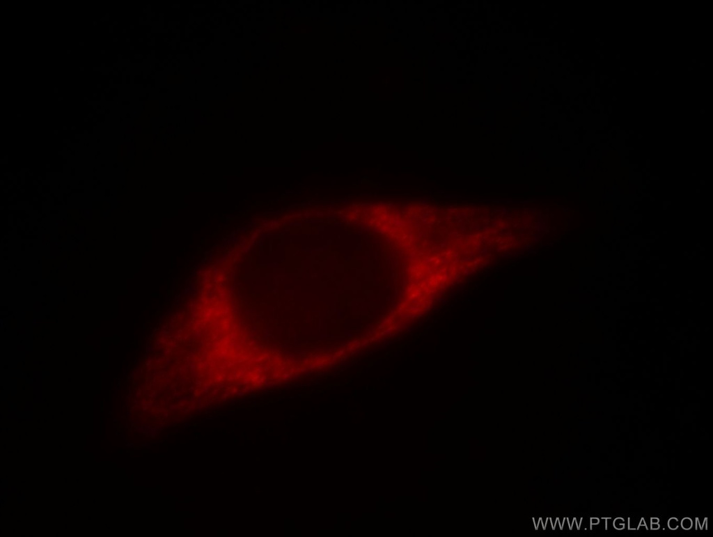 Prohibitin Monoclonal antibody
