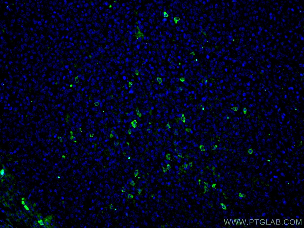 Human IgA Monoclonal antibody