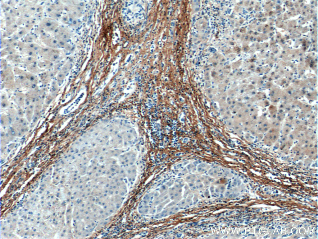 Fibromodulin Monoclonal antibody