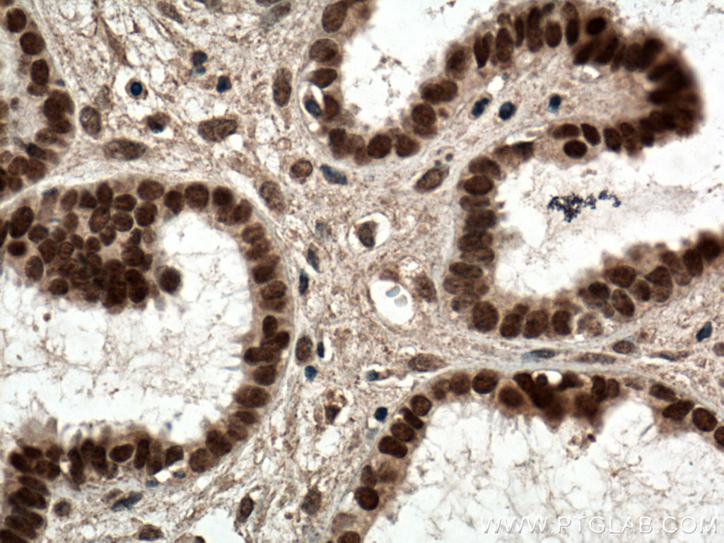 NR2F6 Monoclonal antibody