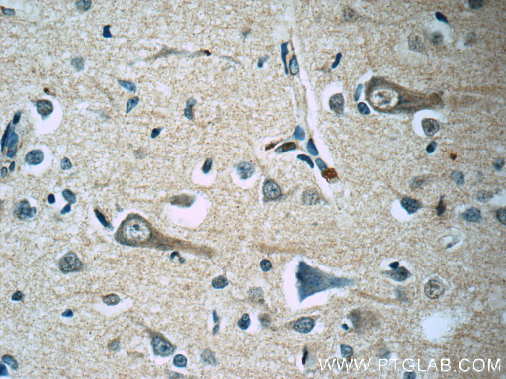 KCNMB4 Monoclonal antibody