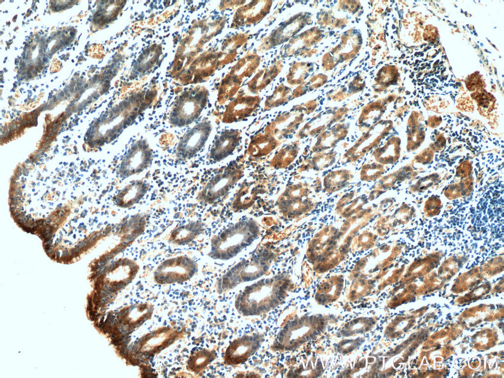 Gastrokine 1 Monoclonal antibody