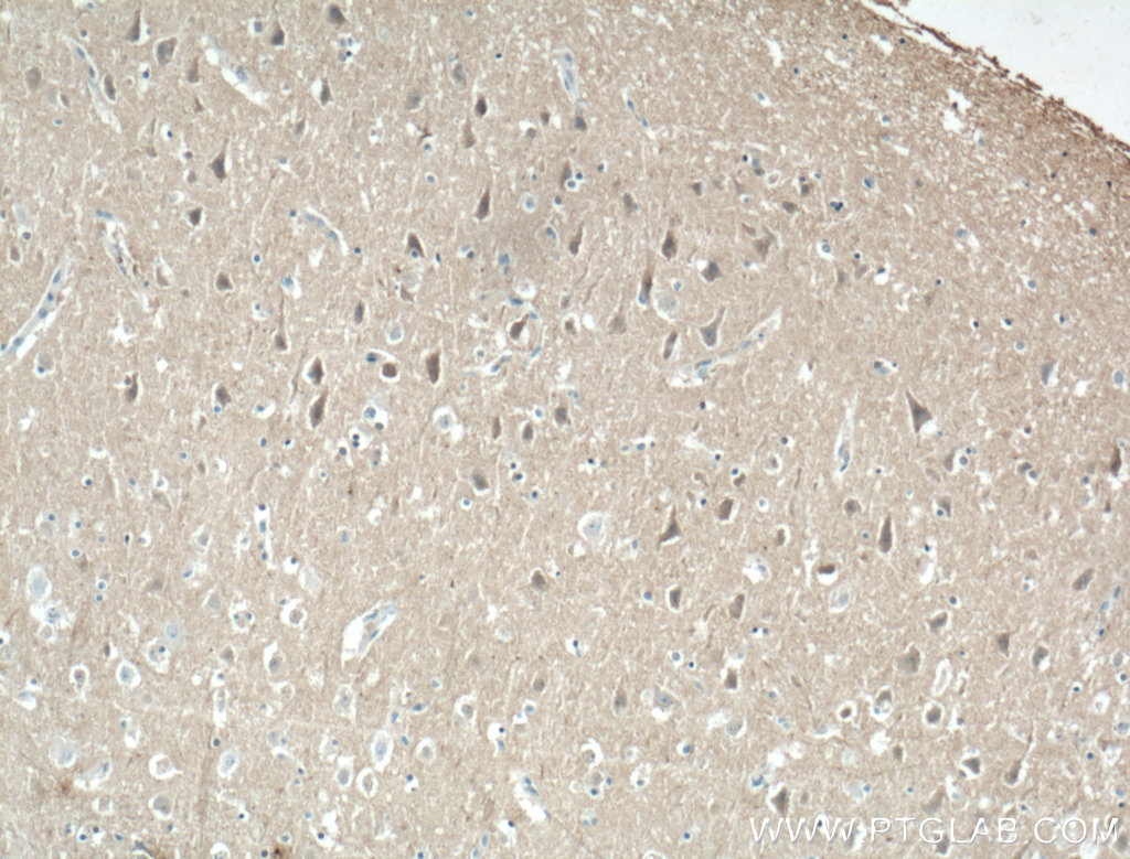KCNIP4 Monoclonal antibody