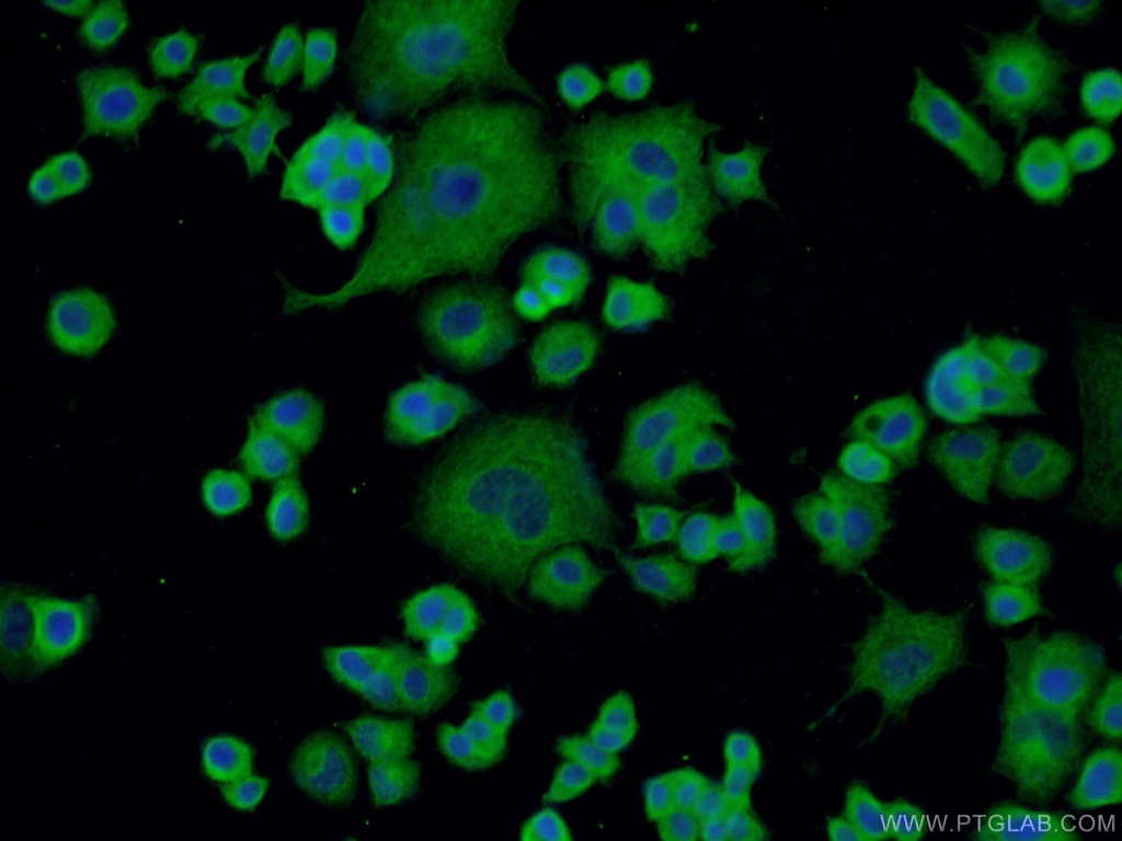 Chromogranin A Monoclonal antibody