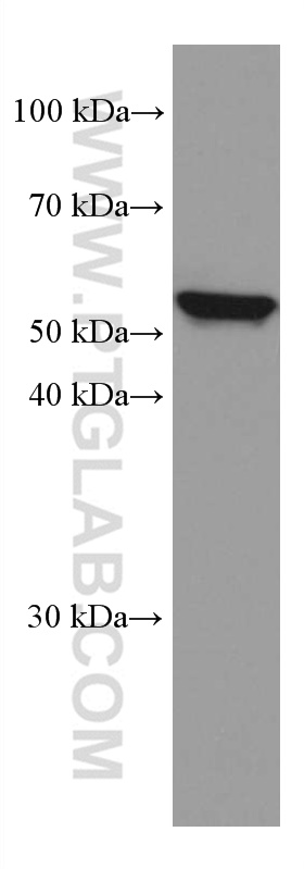 IL-15RA Monoclonal antibody