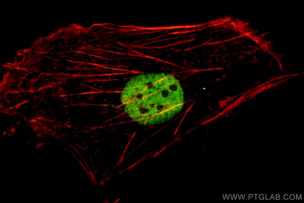 PAX8 Monoclonal antibody