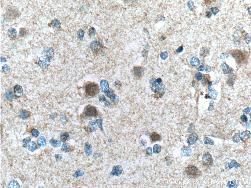 CUL4B Monoclonal antibody