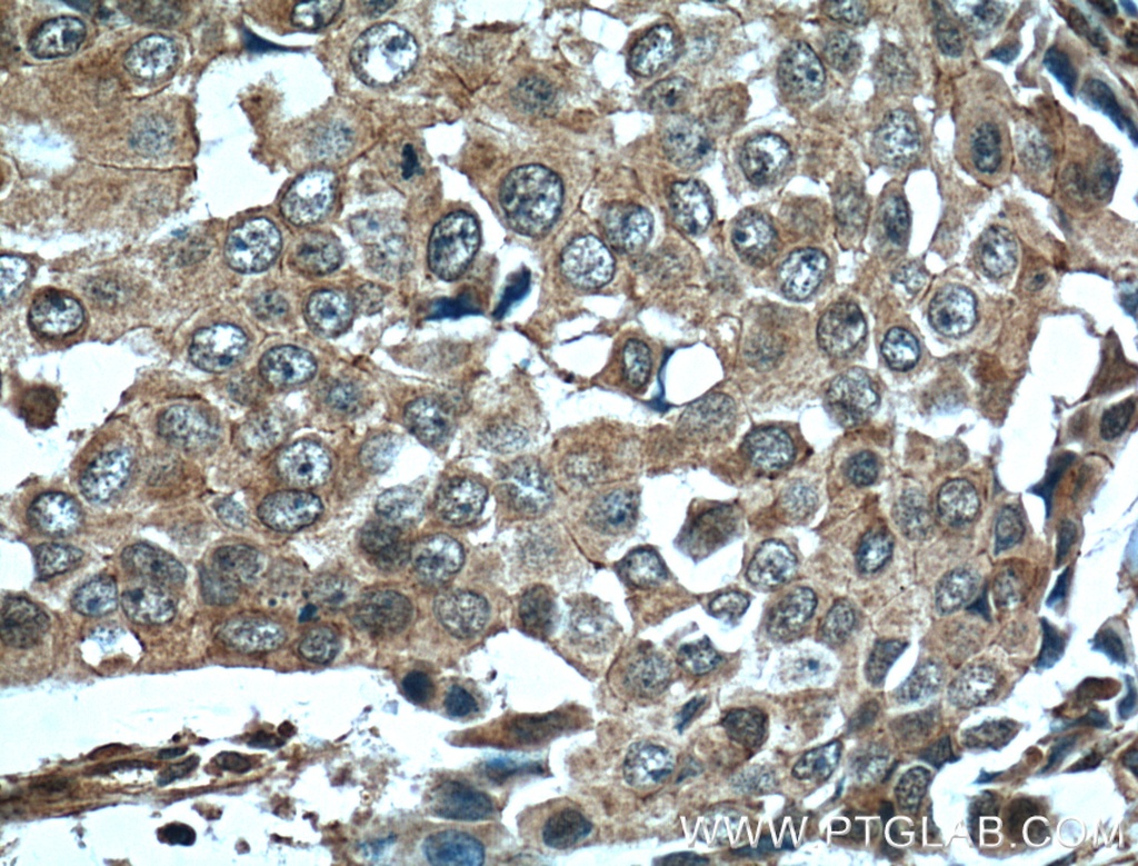 EPHA1-specific Monoclonal antibody