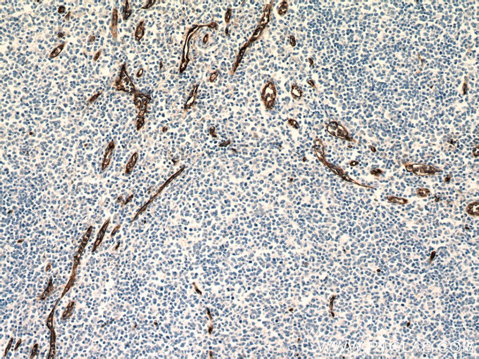CD34 Monoclonal antibody