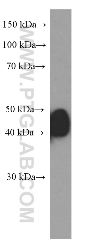 ESR2 Monoclonal antibody