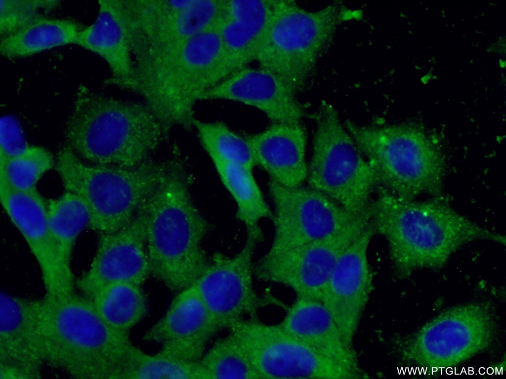 peroxiredoxin 2 Monoclonal antibody