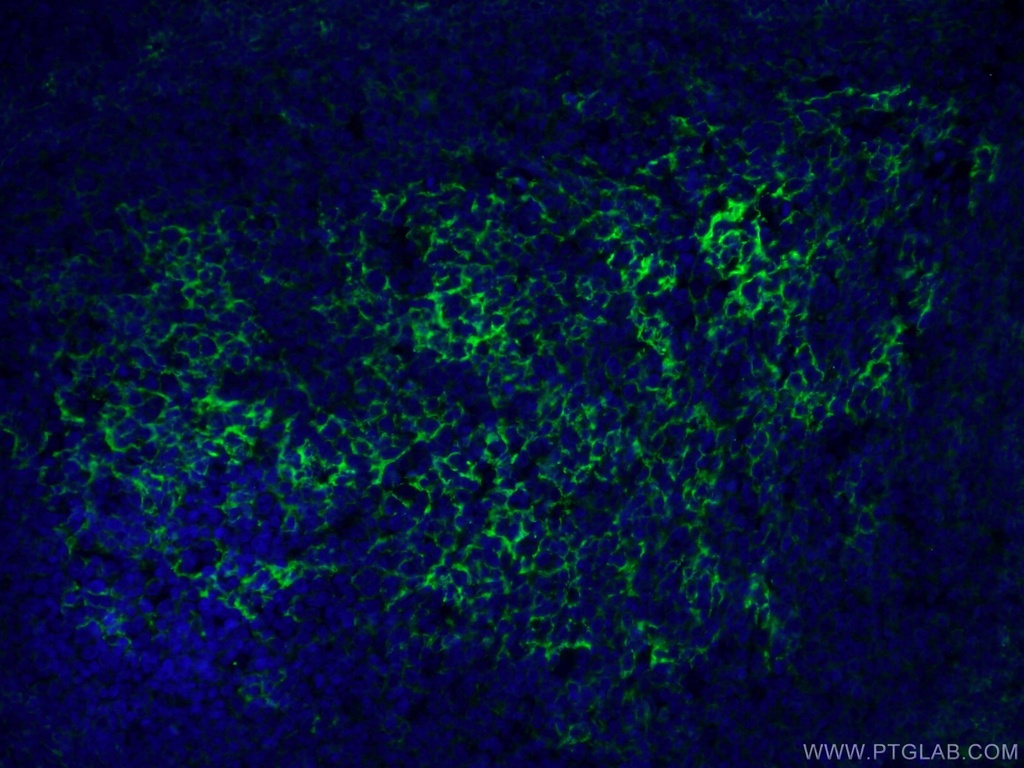 CD23 Monoclonal antibody