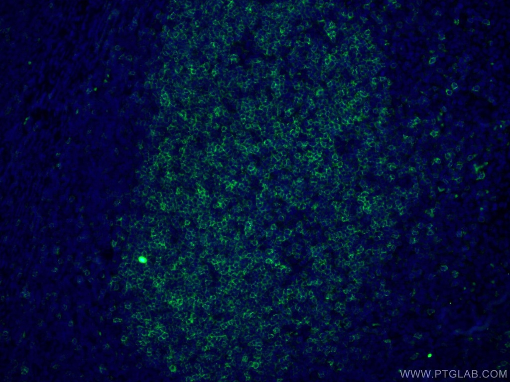 CD23 Monoclonal antibody