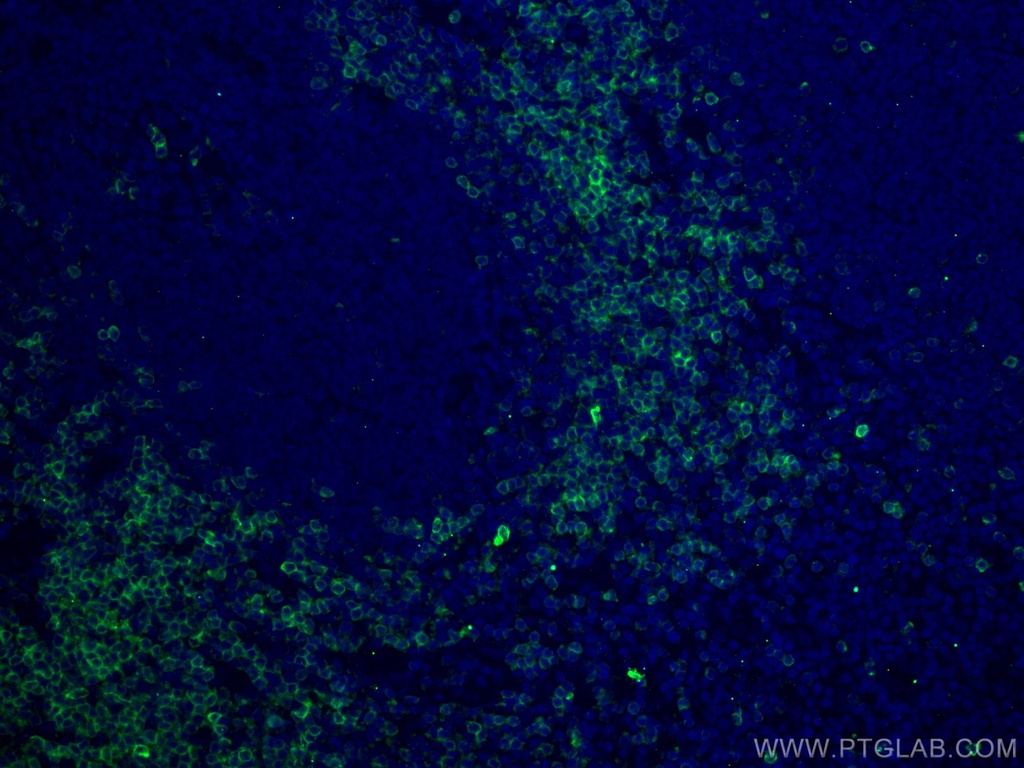 CD7 Monoclonal antibody