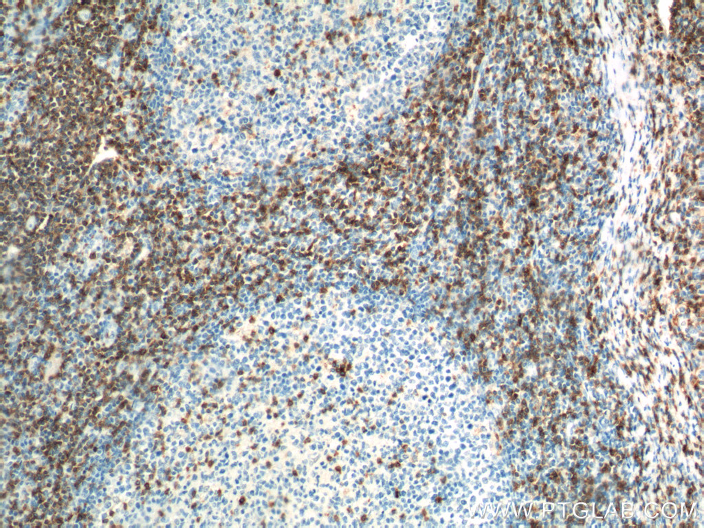 CD7 Monoclonal antibody