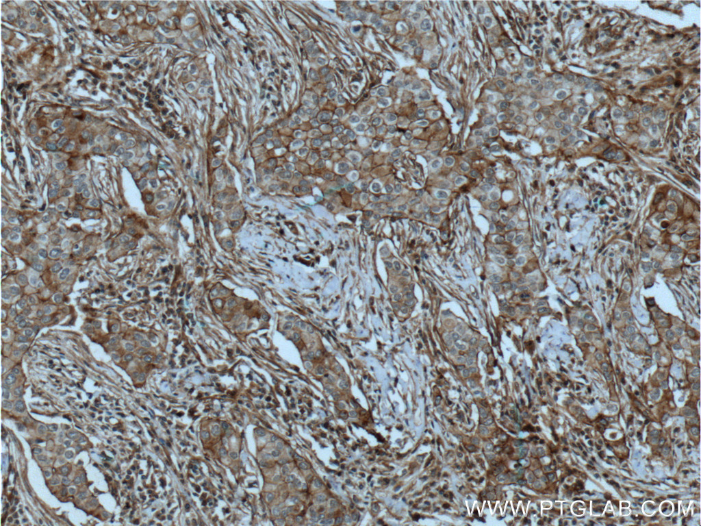 CXCR7 Monoclonal antibody