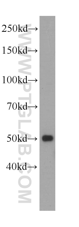 PAX1-Specific Monoclonal antibody