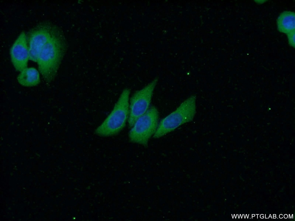 SMMHC Monoclonal antibody