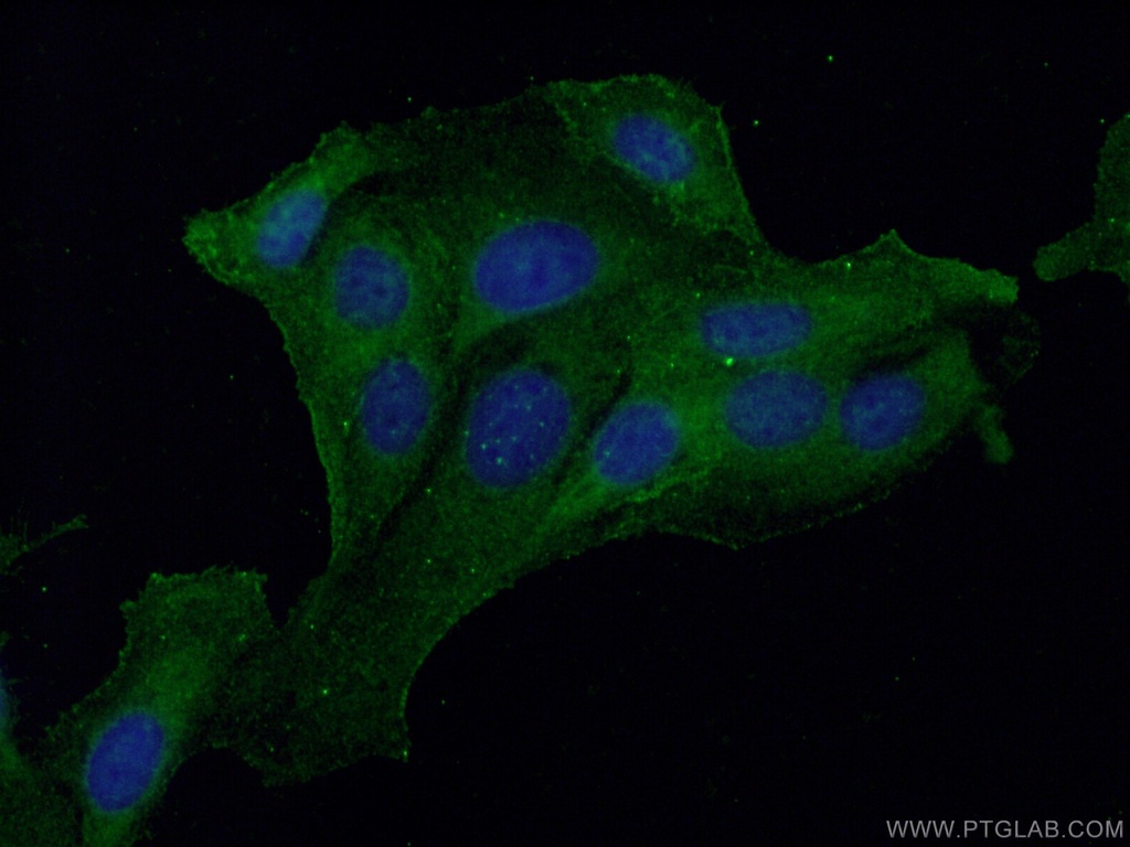 Galectin-1 Monoclonal antibody