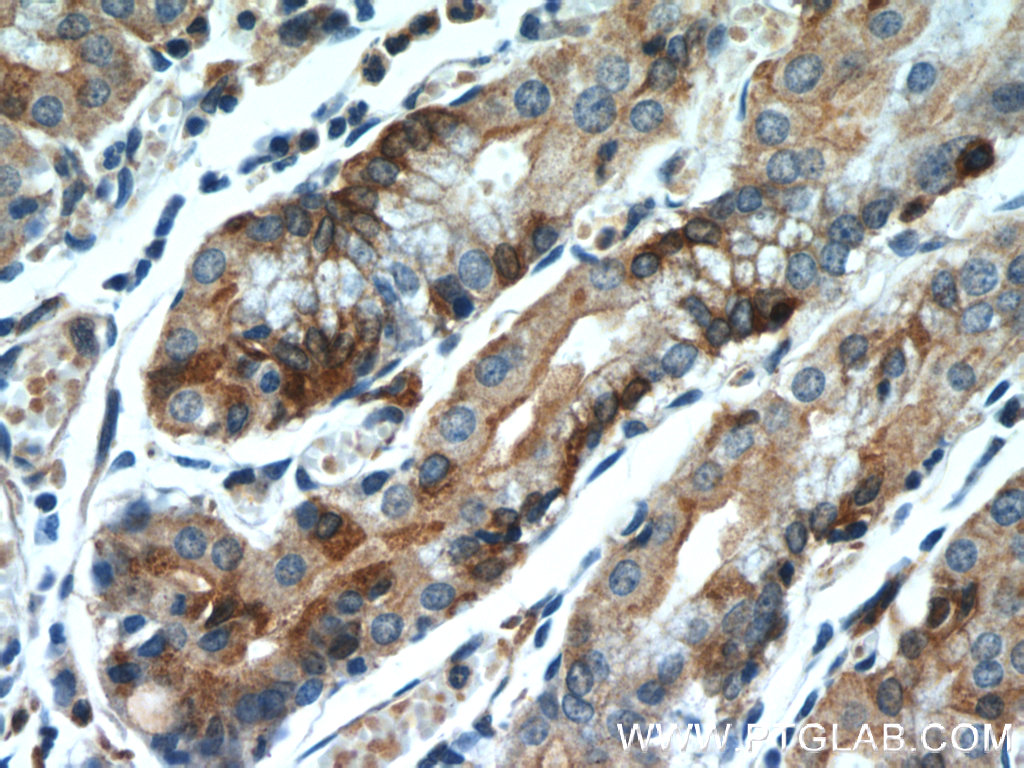 FUT9 Monoclonal antibody