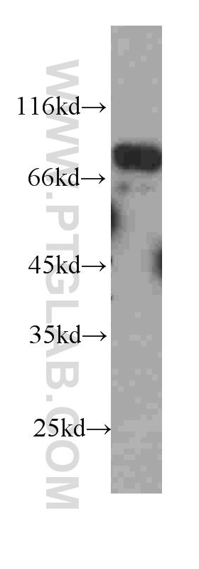 FAF1 Monoclonal antibody