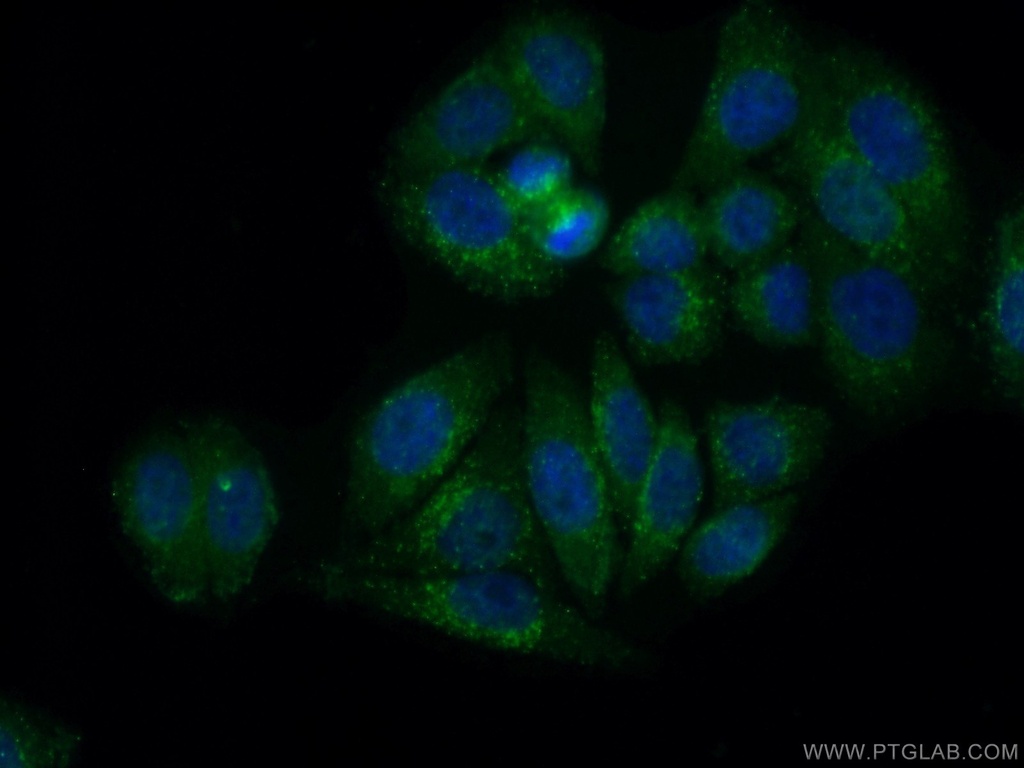 Gamma Cystathionase Monoclonal antibody