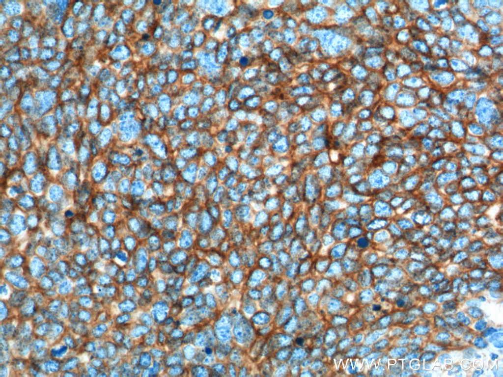 NCAM1/CD56 Monoclonal antibody