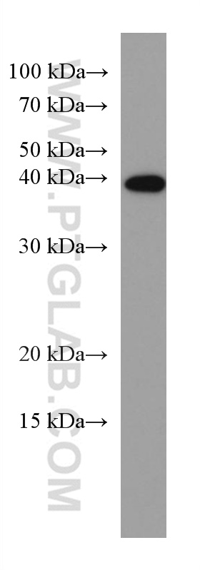 CDX2 Monoclonal antibody