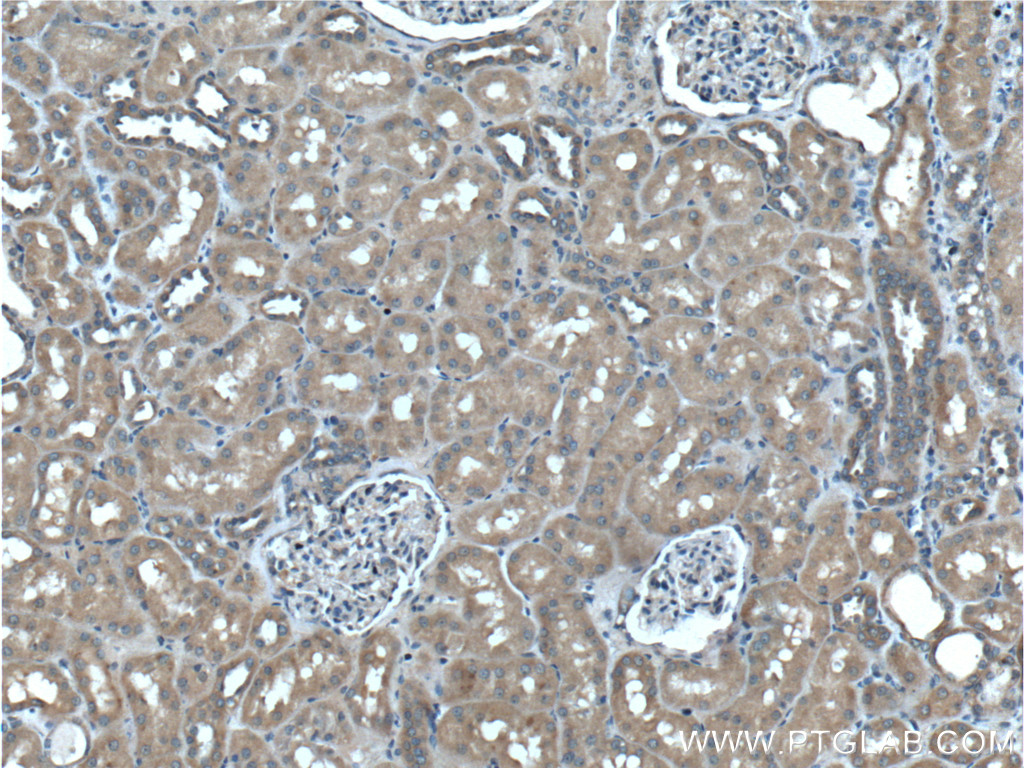 PLAA Monoclonal antibody