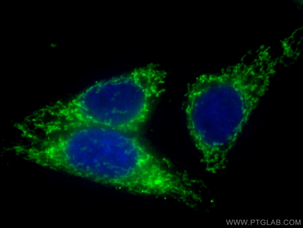 HADHA Monoclonal antibody