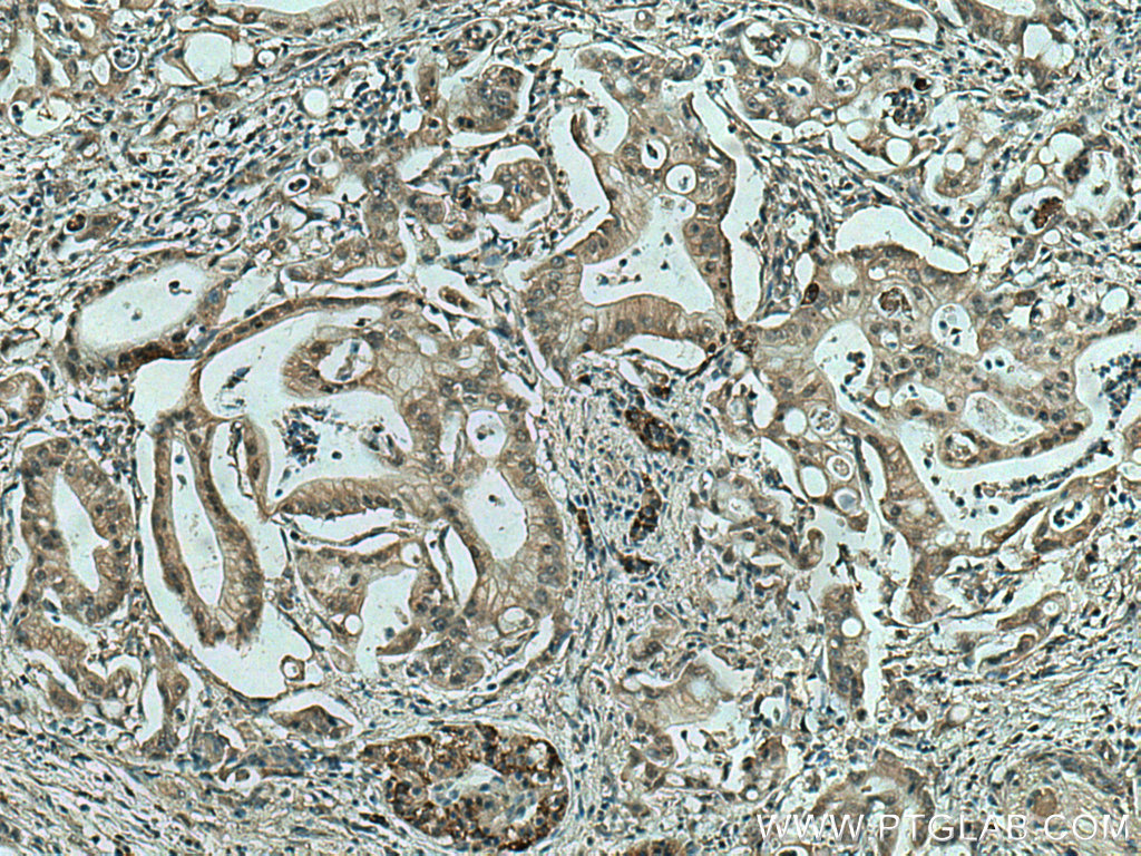 MAPK13 Monoclonal antibody