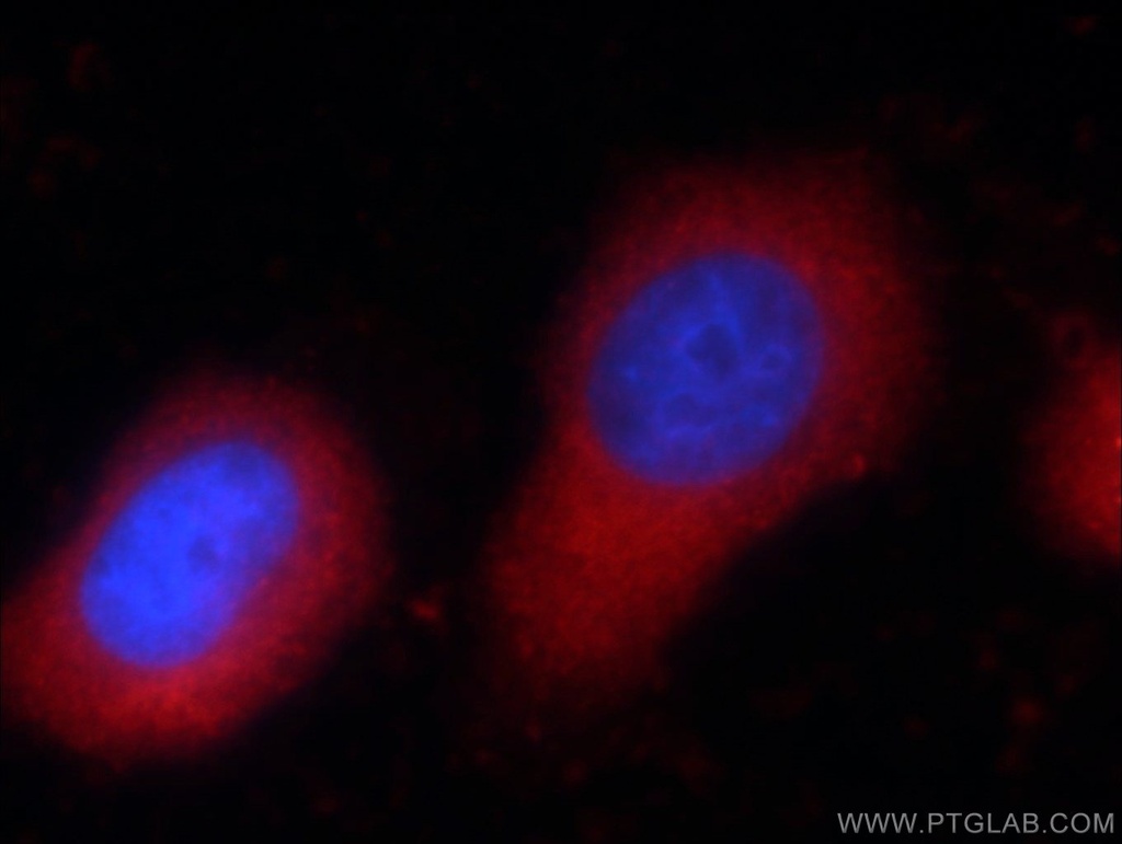 Zyxin Monoclonal antibody
