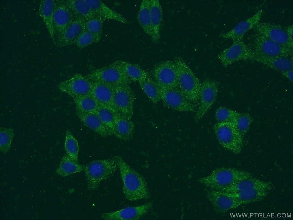 SMN-Exon7 Monoclonal antibody