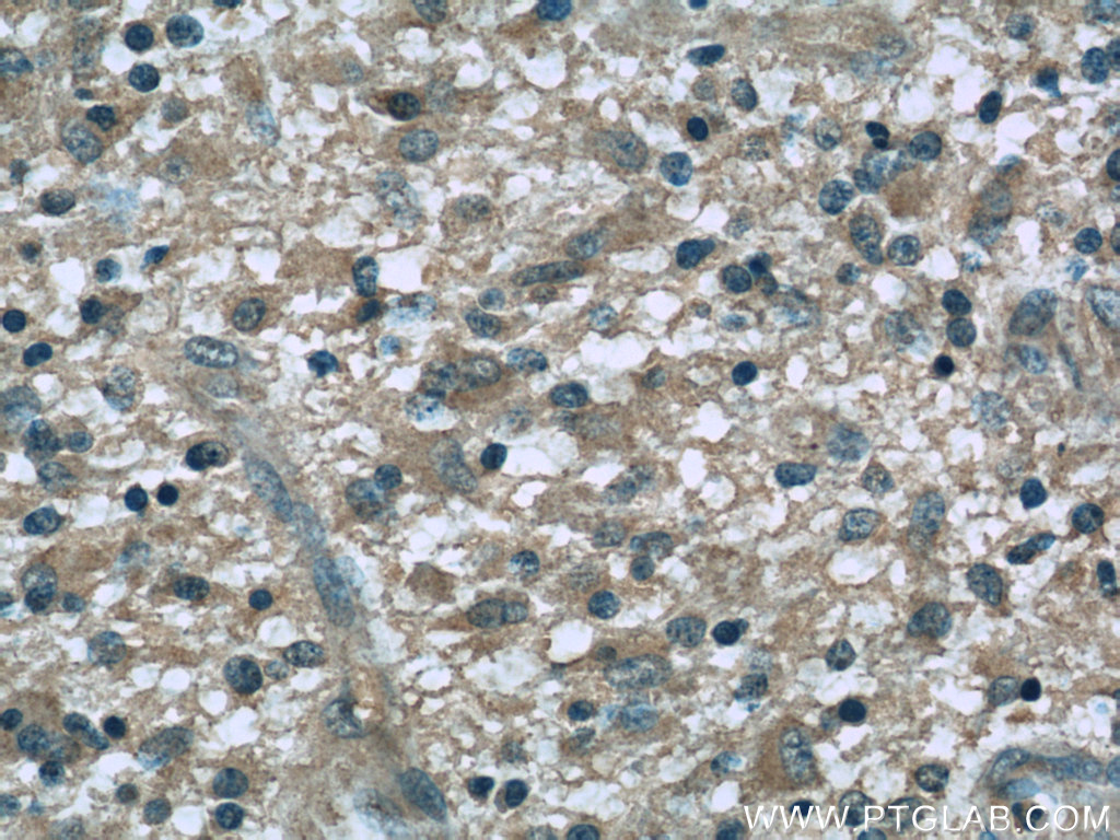 Dynamitin (1-401 AA) Monoclonal antibody