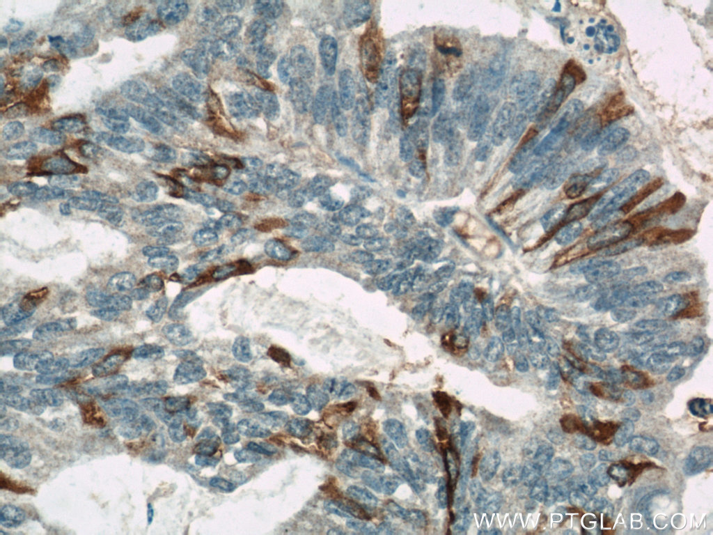 MUC16,CA125 Monoclonal antibody
