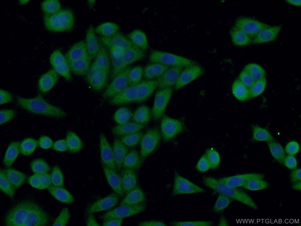 IL-1R2 Monoclonal antibody