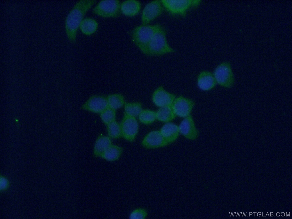 MEST Monoclonal antibody