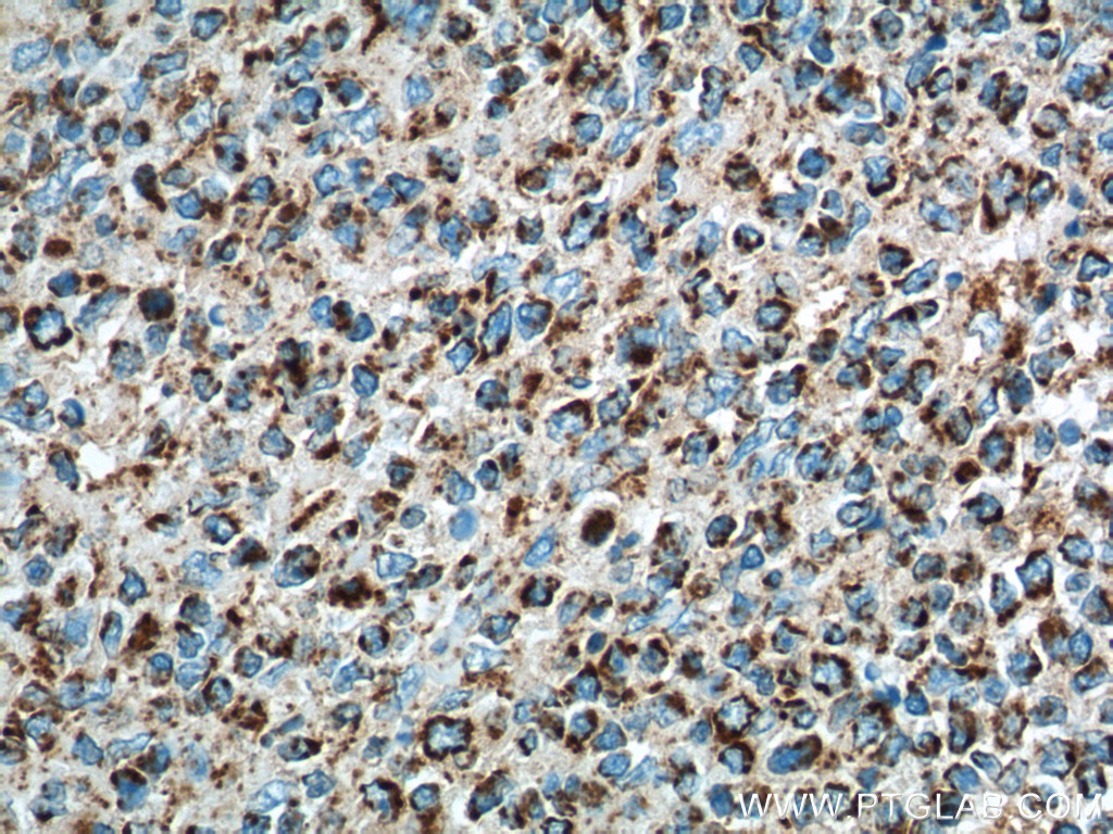 IL-19 Monoclonal antibody