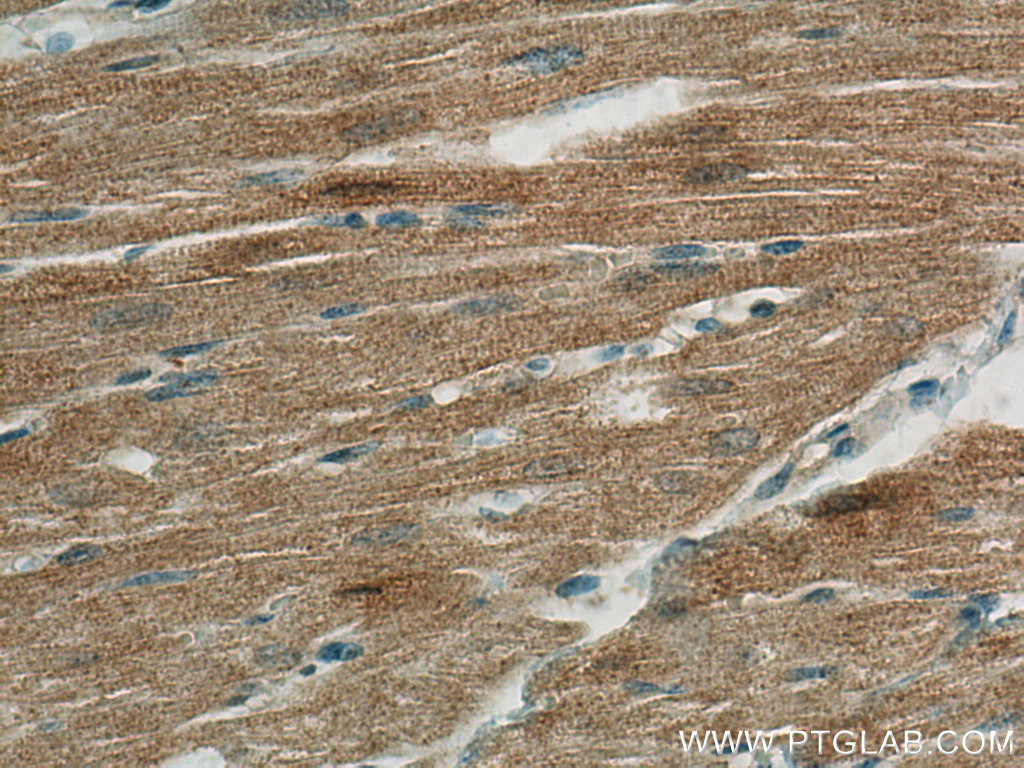 FABP3 Monoclonal antibody