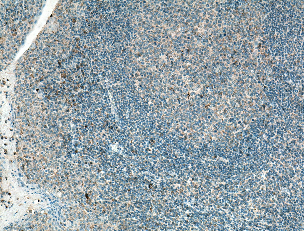 IL-36 Beta/IL-1F8 Monoclonal antibody