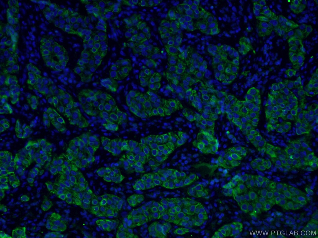 TNF Alpha Monoclonal antibody